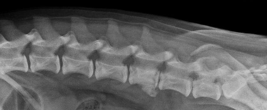 Spondylose er en sykdom i ryggraden som vanligvis finnes hos eldre hunder som forårsaker ny beinvekst langs